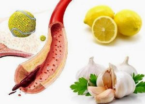 Какие продукты на самом деле забивают сосуды