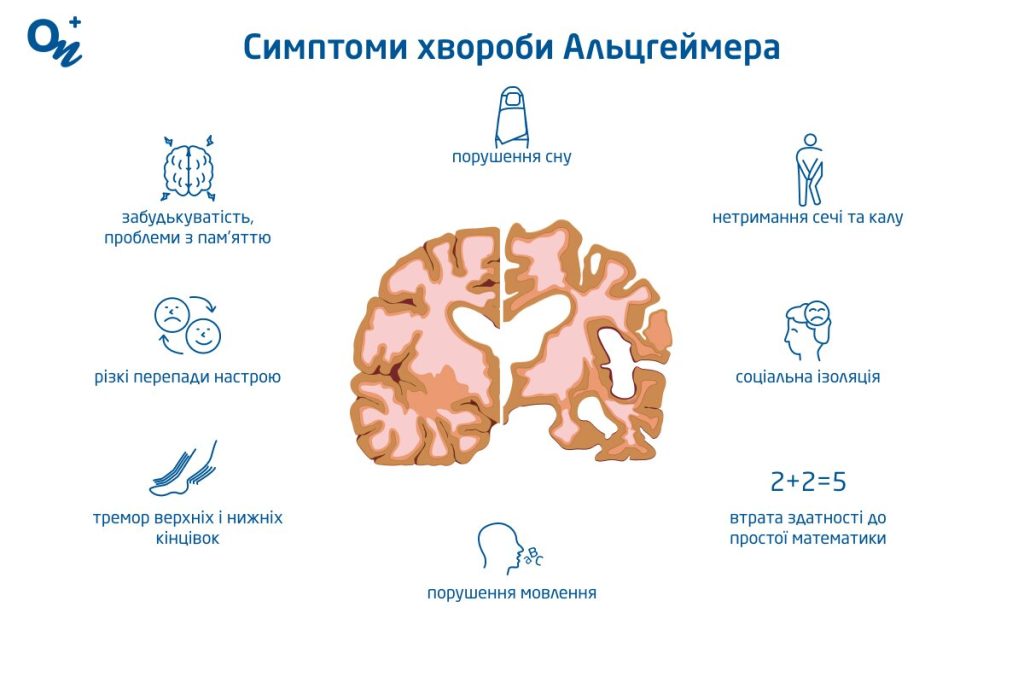 Перші симптоми Альцгеймера: як розпізнати вчасно