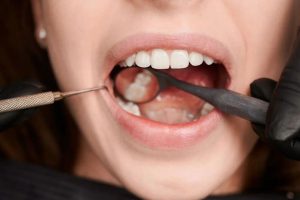 Після імплантації зубів: п’ять речей, яких варто уникати