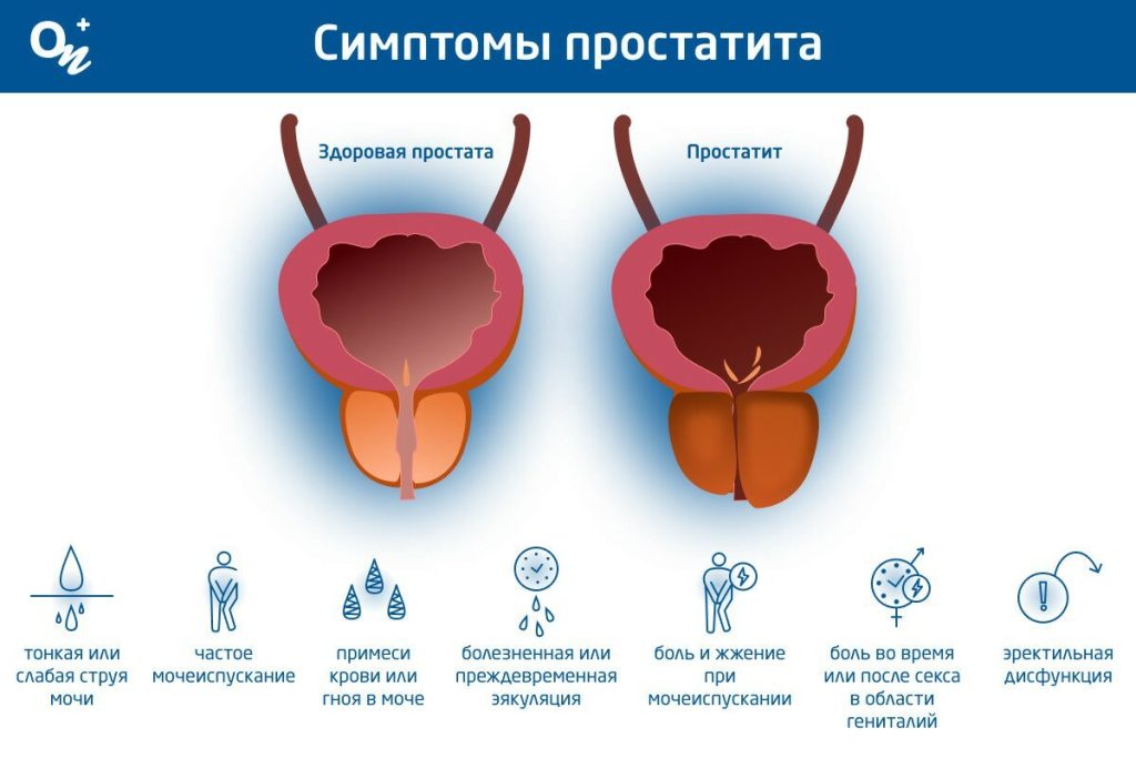 Симптоми простатиту: як розпізнати і не пропустити